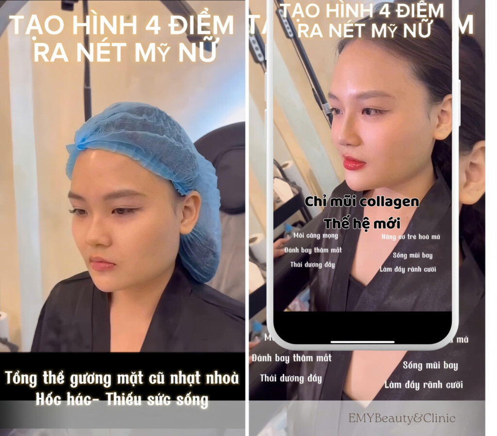 nang tam ve dep tai emybeautyclinic voi dich vu filler botox va dao tao ky thuat vien chuyen nghiep 6